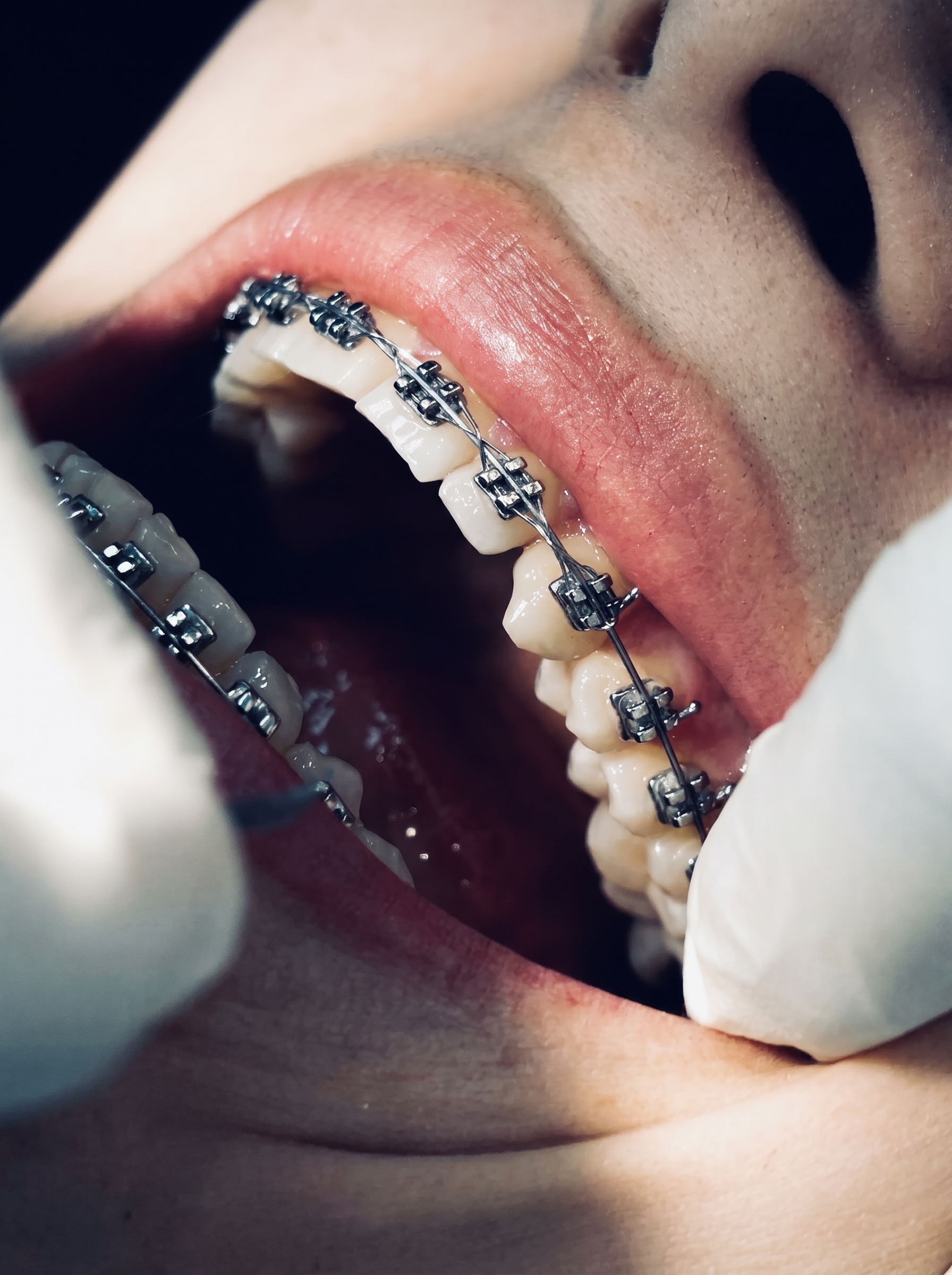 Orthodontics